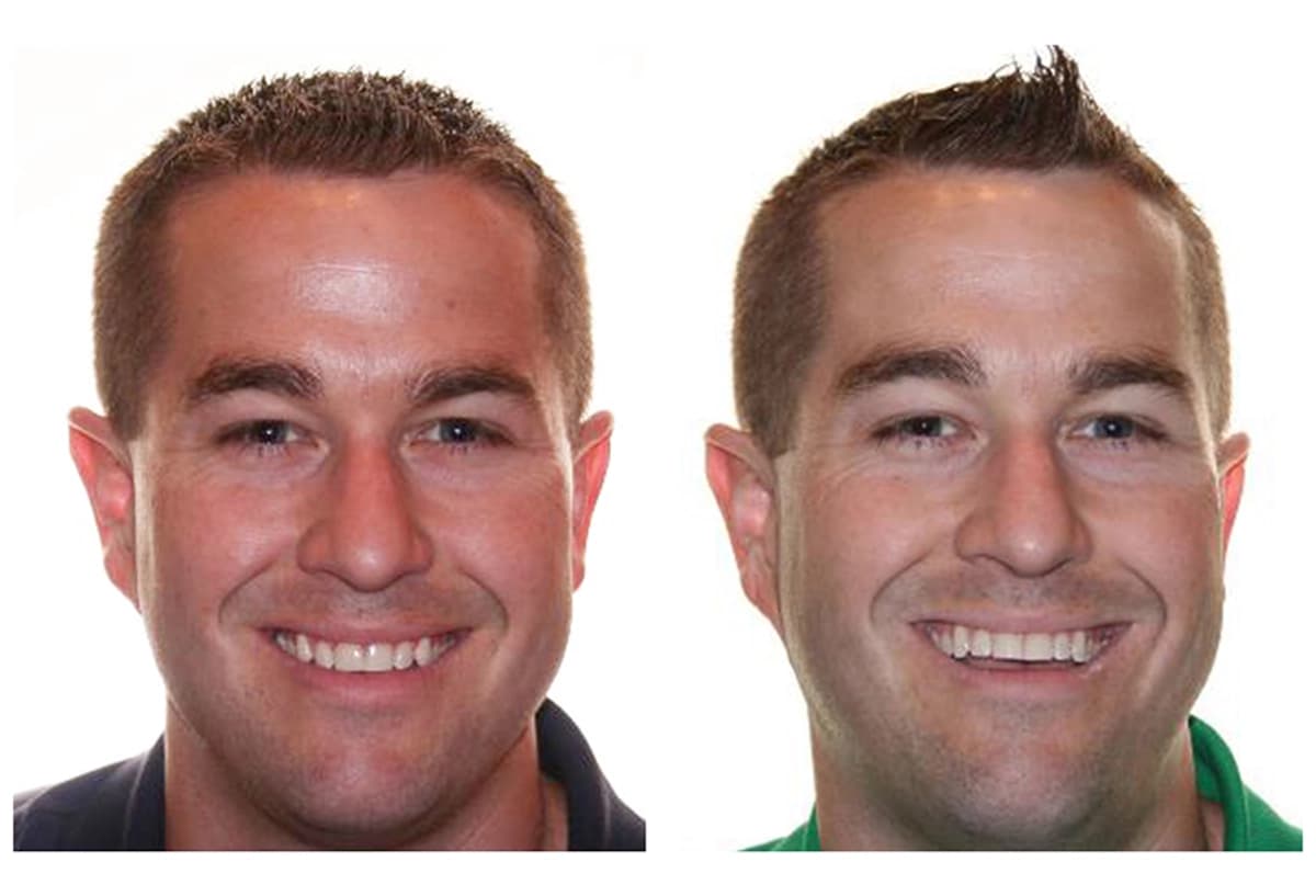 Before and After