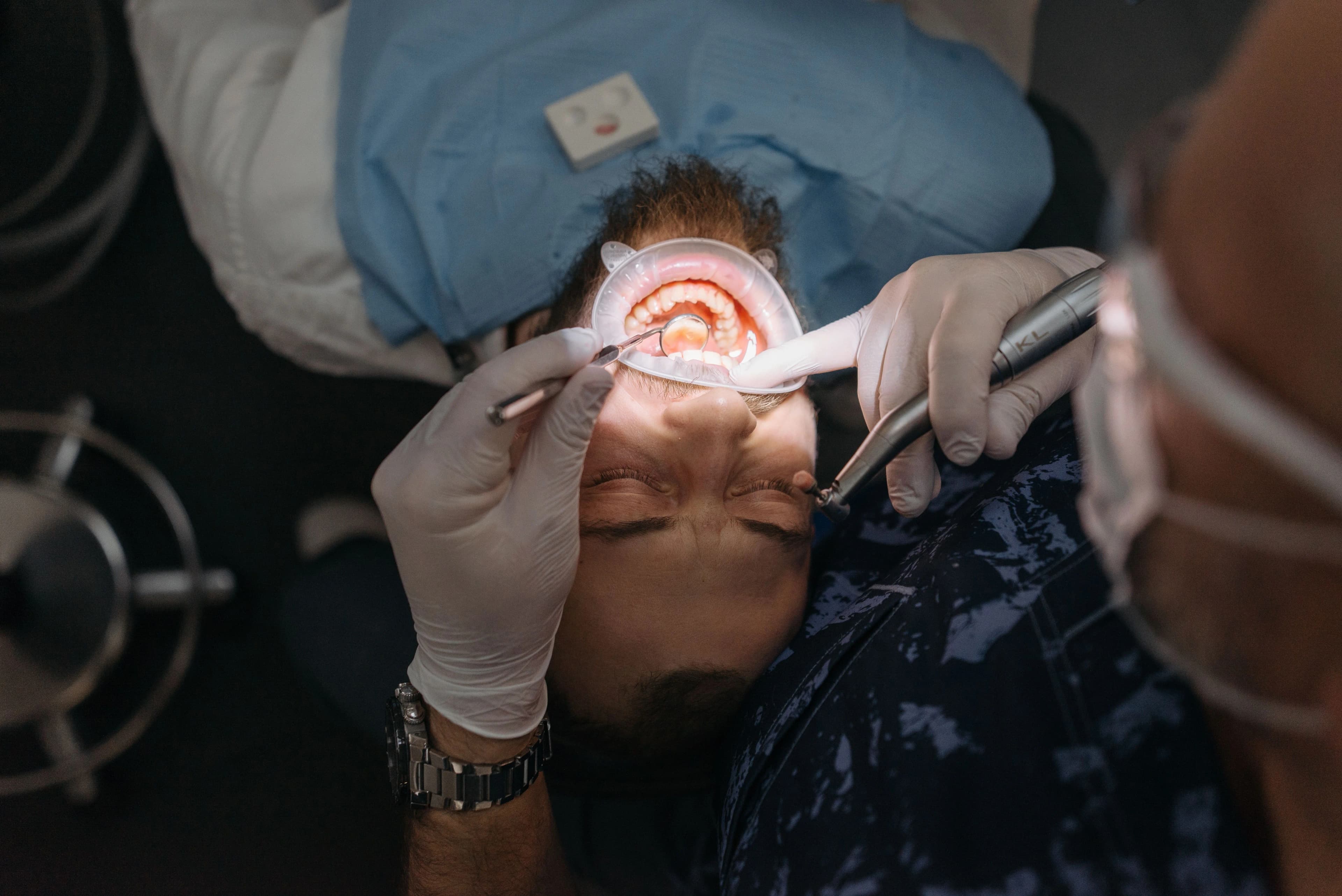 Photo dentist performing dental fillings in Astoria on patient