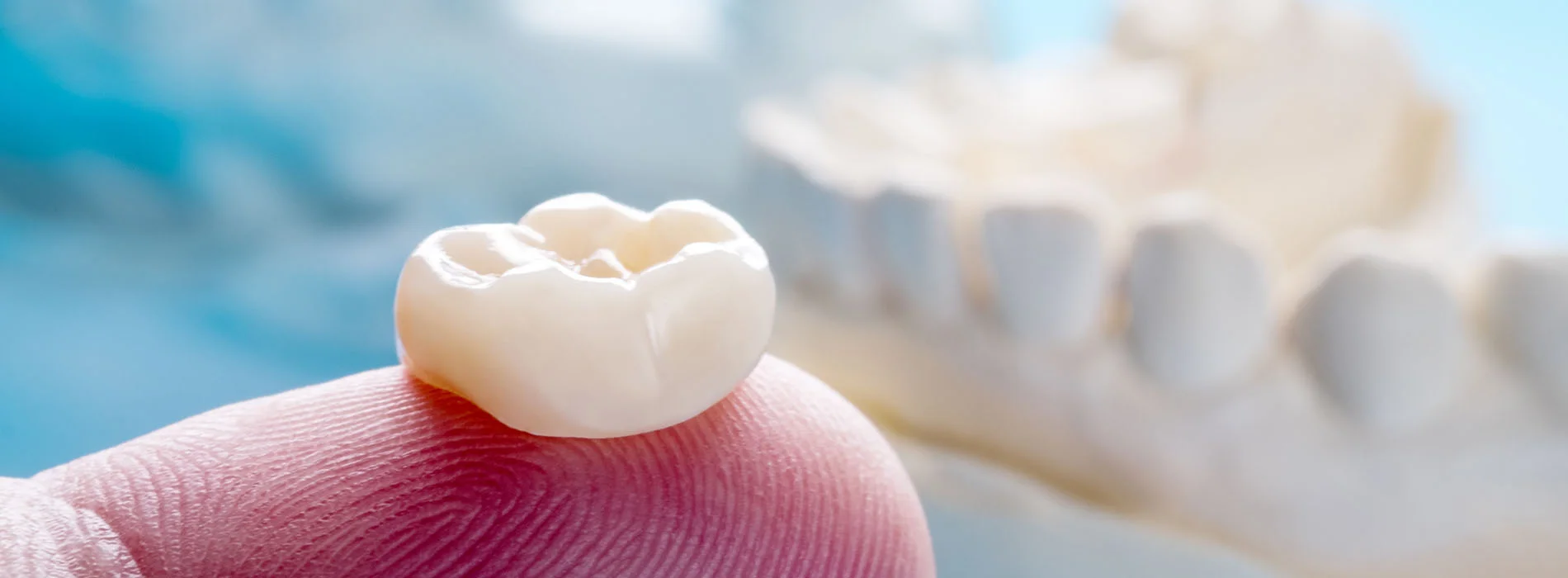 Close up of finger holding single dental crown with tooth model in background showing dental crowns Astoria treatment and restoration.