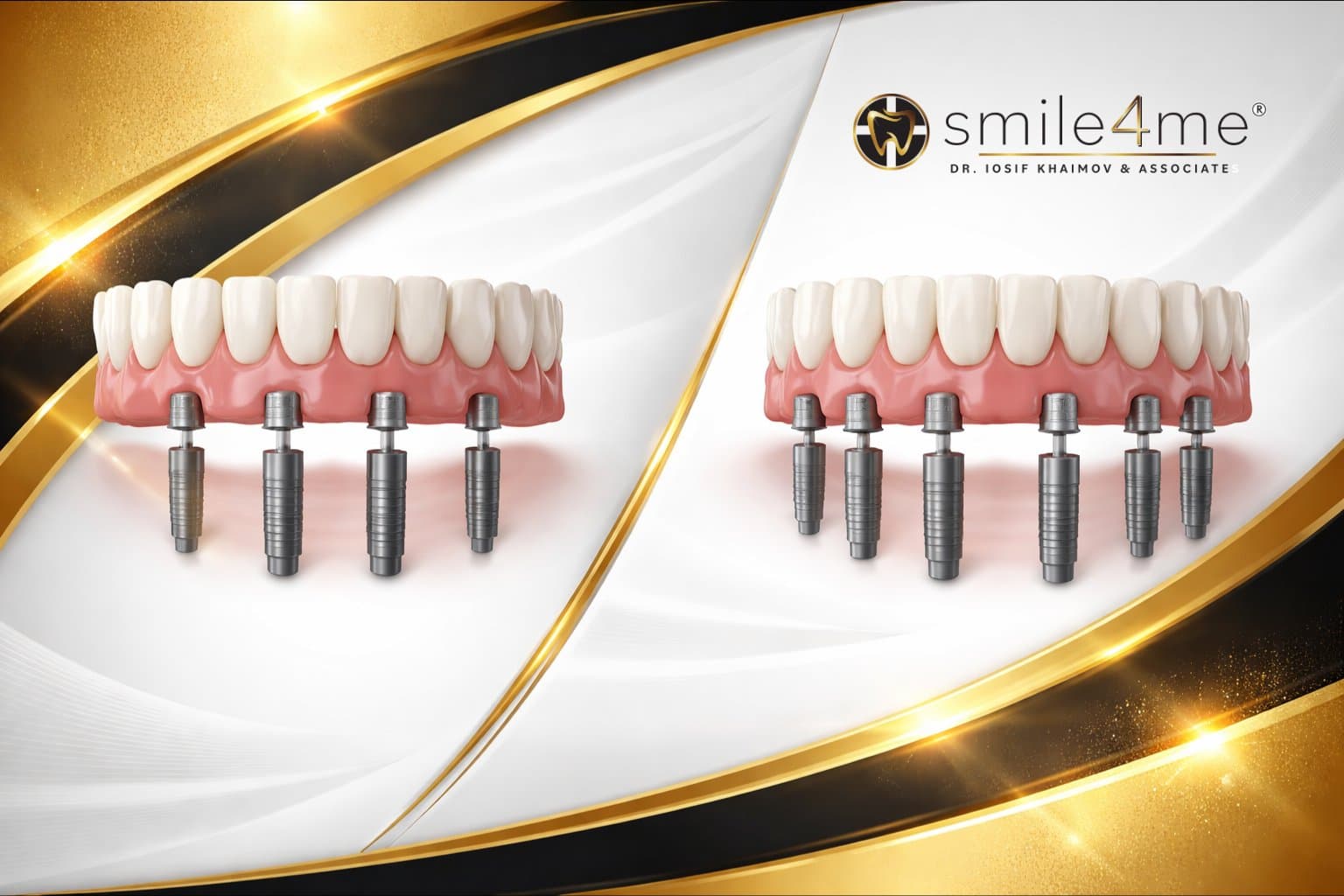 graphic-comparison-of-two-full-arch-dental-implant-prosthetics-with-four-and-six-implant-posts-beside-smile4me-logo