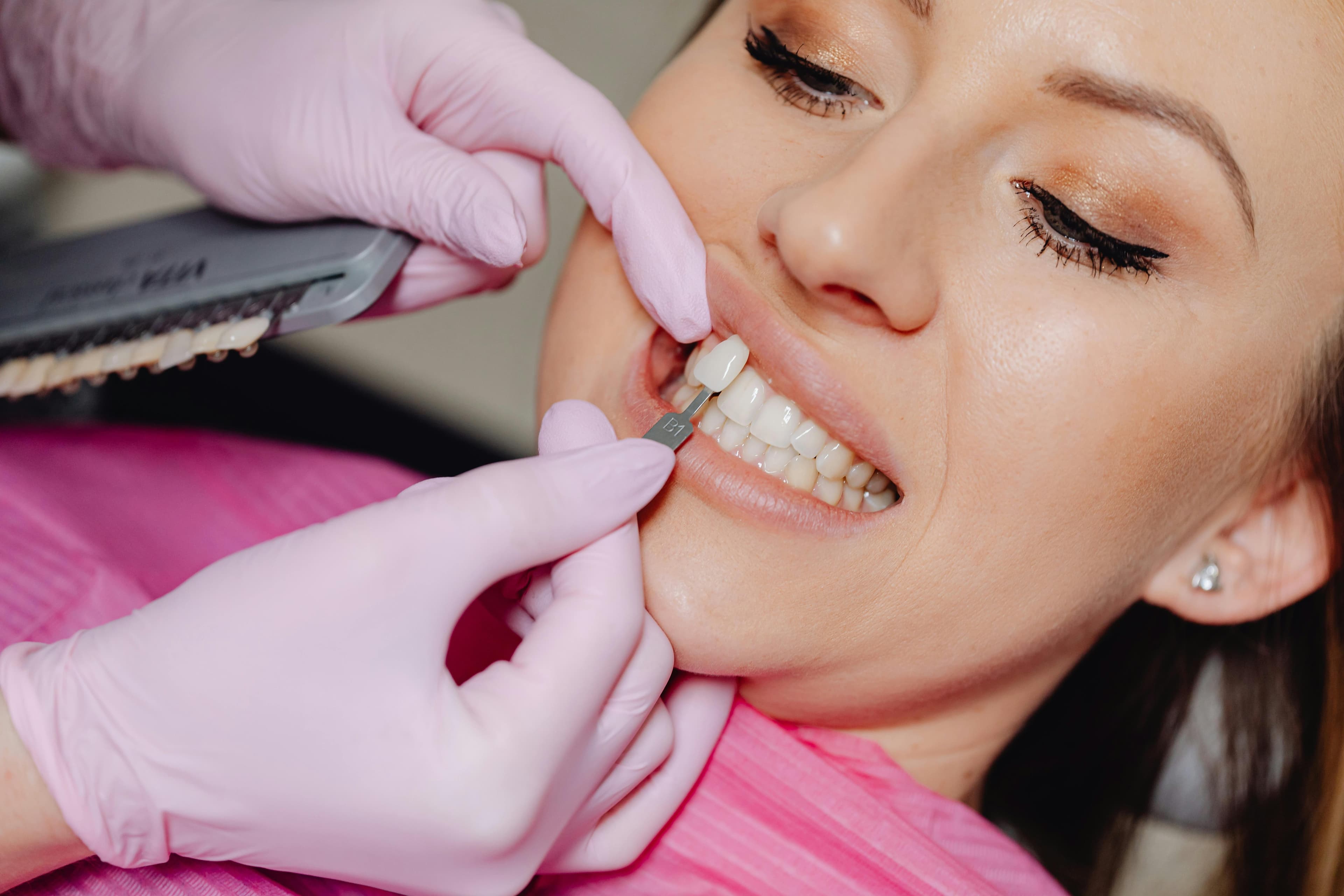 Dentist With Pink Gloves Holding Shade Guide Against Patient Teeth Showing How Do Veneers Work During Cosmetic Dental Consultation