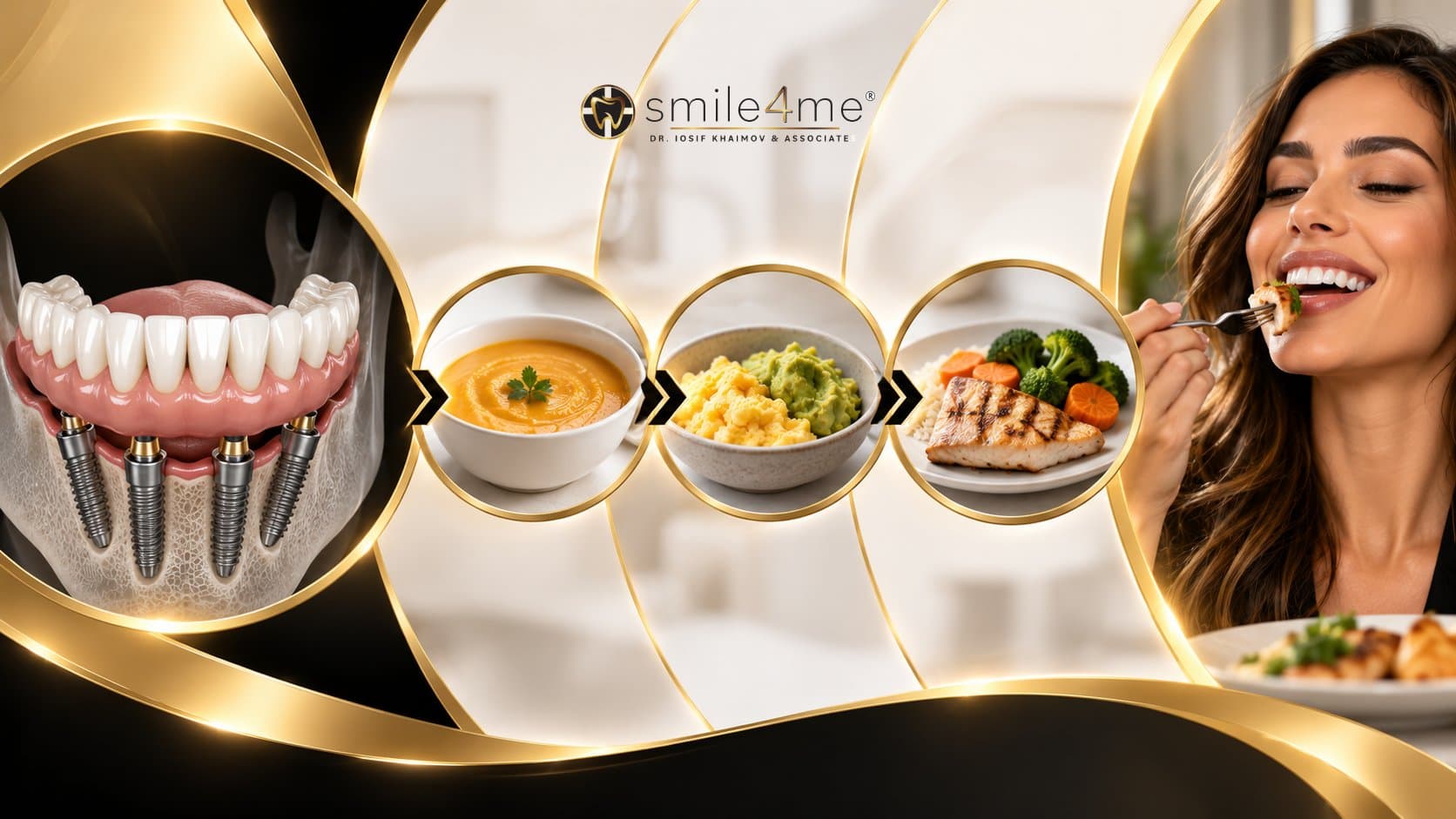 Graphic Showing Food Progression For How Long After All On 4 Dental Implants Can I Eat Normally