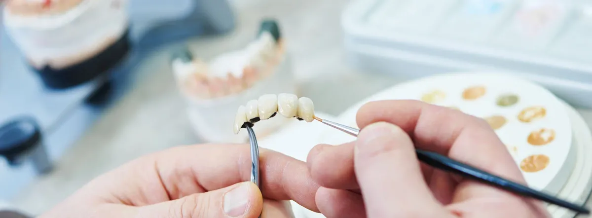 Dental Technician Holding Bridge Restoration And Applying Color Using A Small Brush In Lab Showing Different Alternatives To Dental Implants