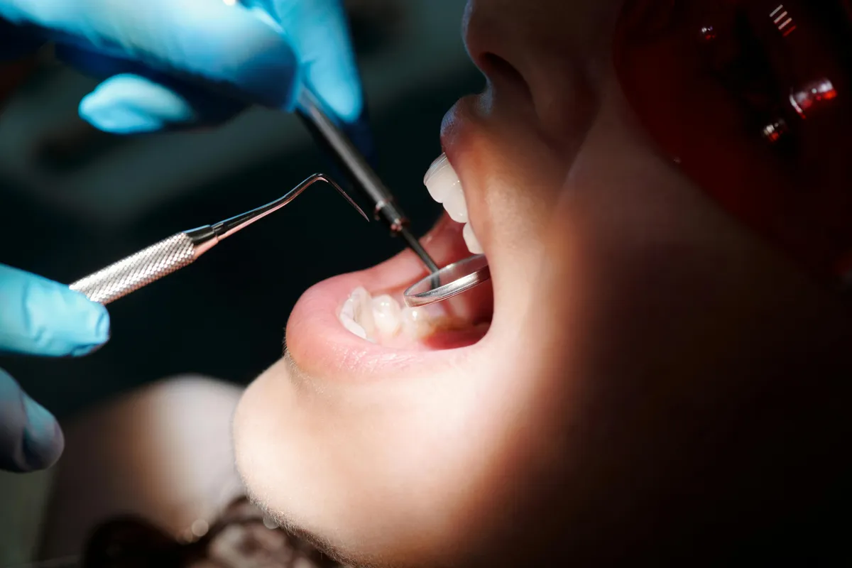 Close Up Of Dentist Examining Patient Teeth With Dental Tools During Checkup Showing Procedure Related To Is A Dental Abscess An Emergency In Dental Office