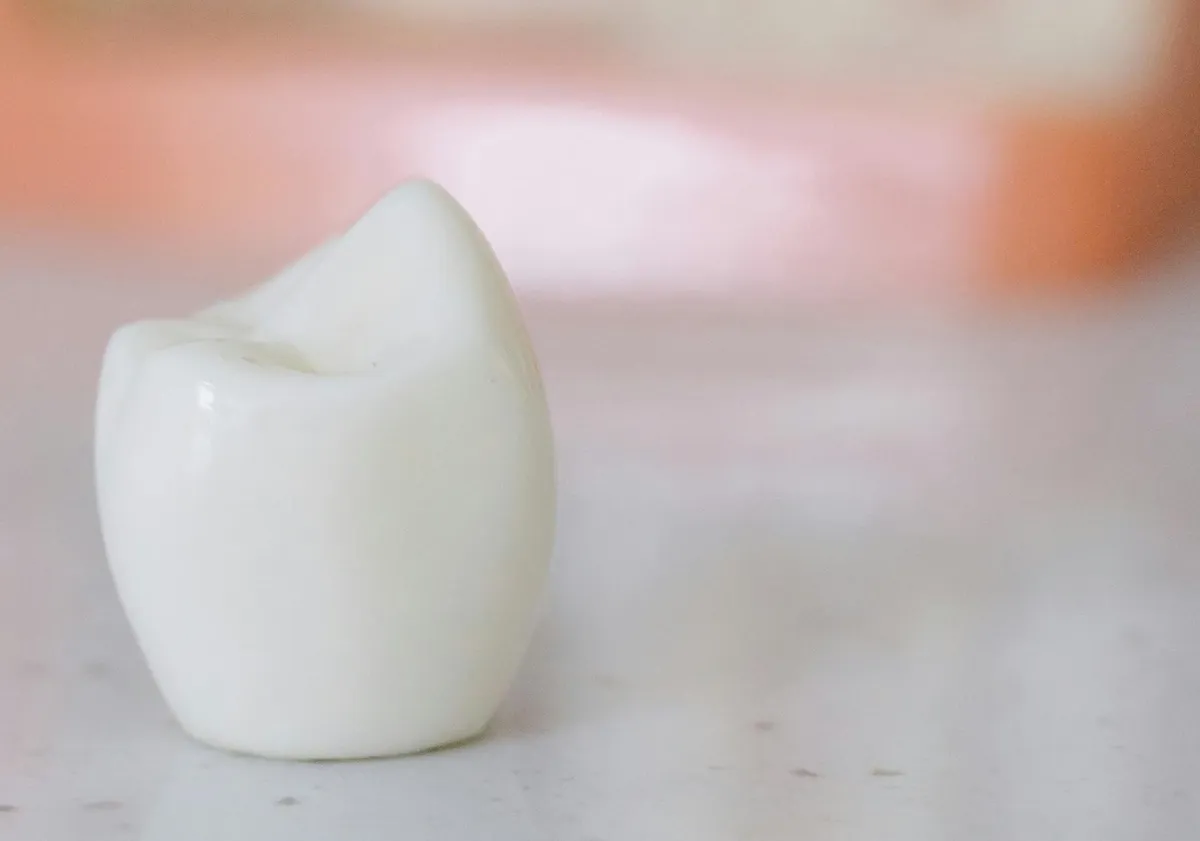 Ceramic Tooth Model On White Surface With Dental Implant Diagram In Background Showing Do Dental Implants Fall Out Concept (1)