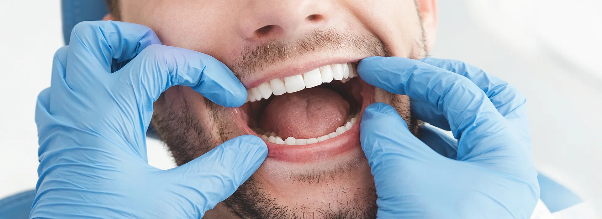 Close up of dentist hands in blue gloves checking male patient smile showing upper and lower teeth while discussing single tooth denture options for tooth replacement.