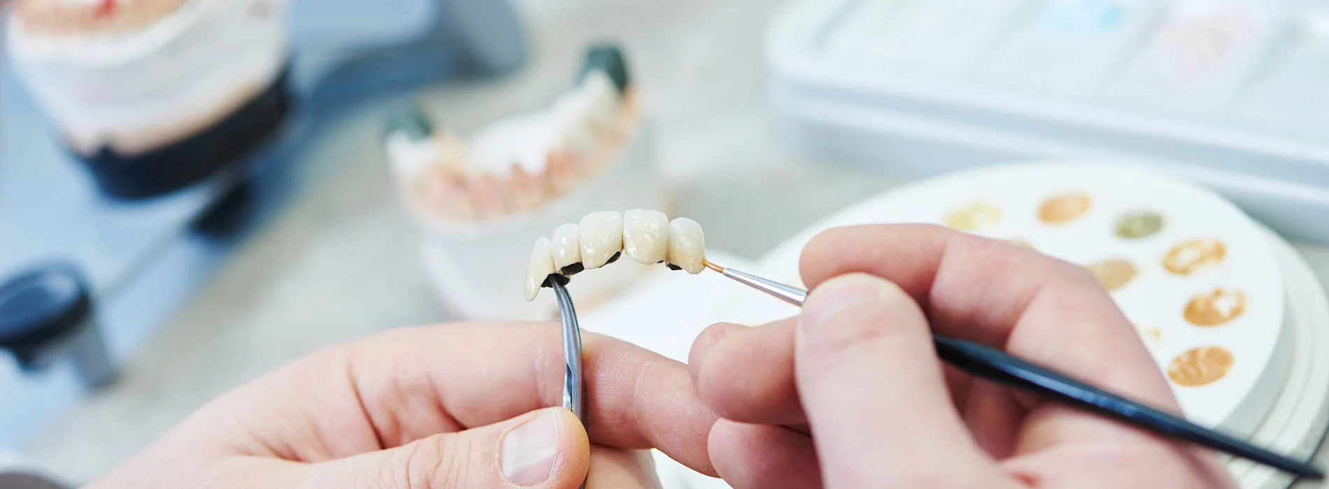 Dental technician holding bridge restoration and applying color using a small brush in lab showing different alternatives to dental implants.