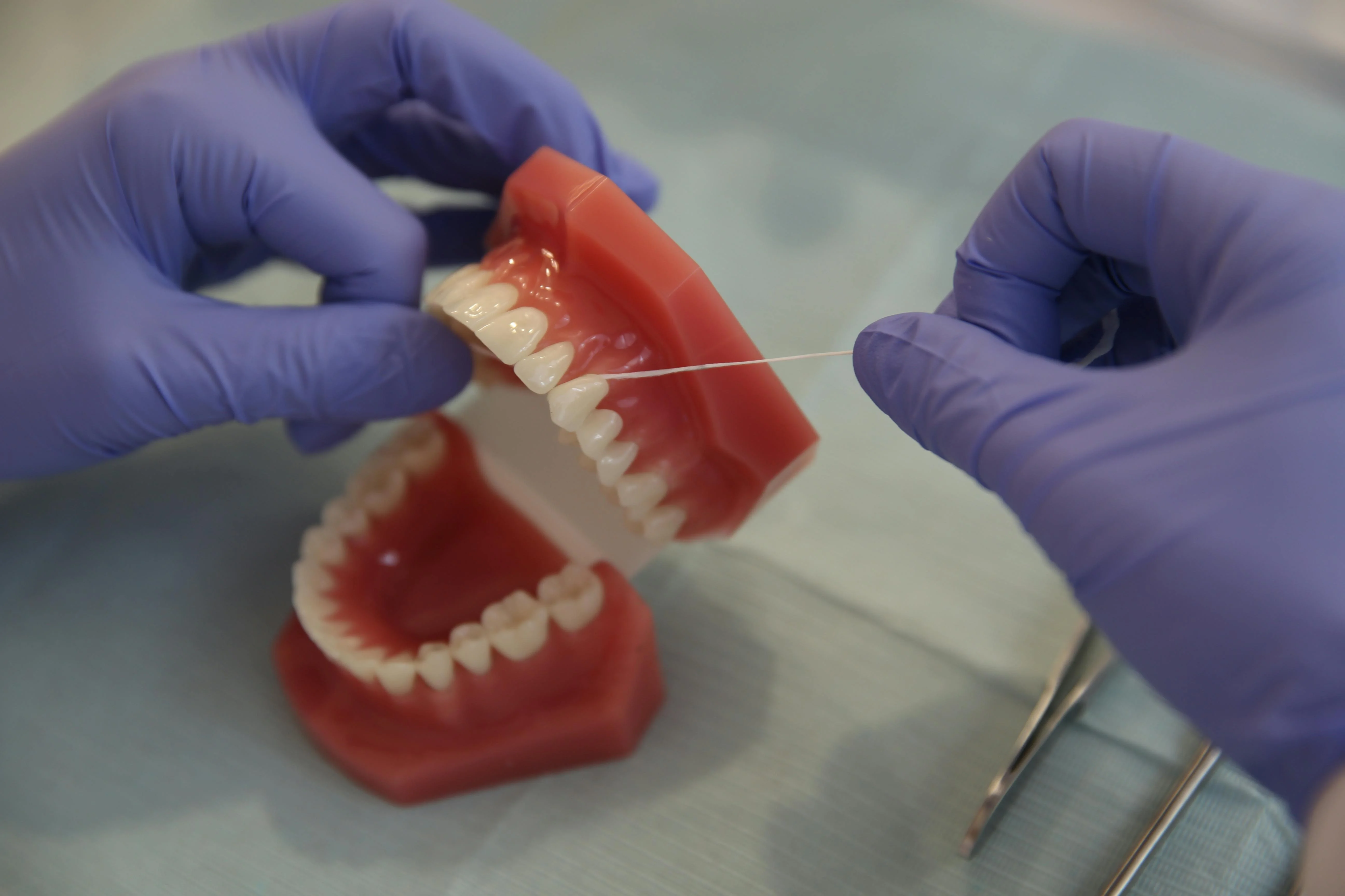 Hands in purple gloves using dental floss on dental model demonstrating proper maintenance of dental implants and flossing technique for optimal oral hygiene.