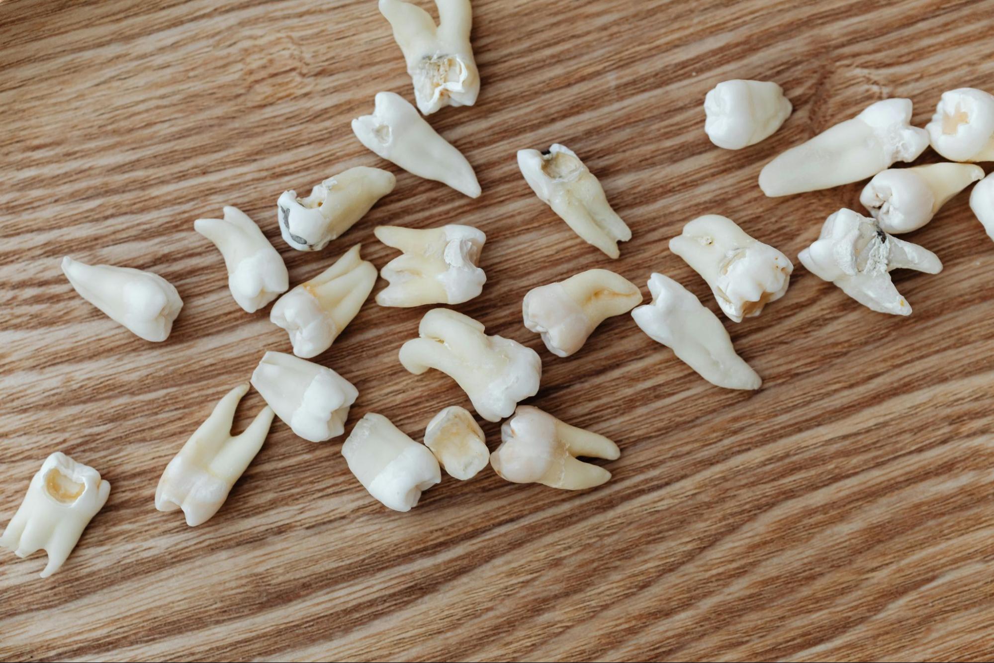 Is a chipped tooth a dental emergency - Scattered human teeth on wooden surface with varied shapes colors showing signs of dental work and damage.