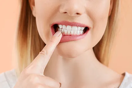 Woman pointing to her lower gums showing teeth close up with neutral expression on face.
