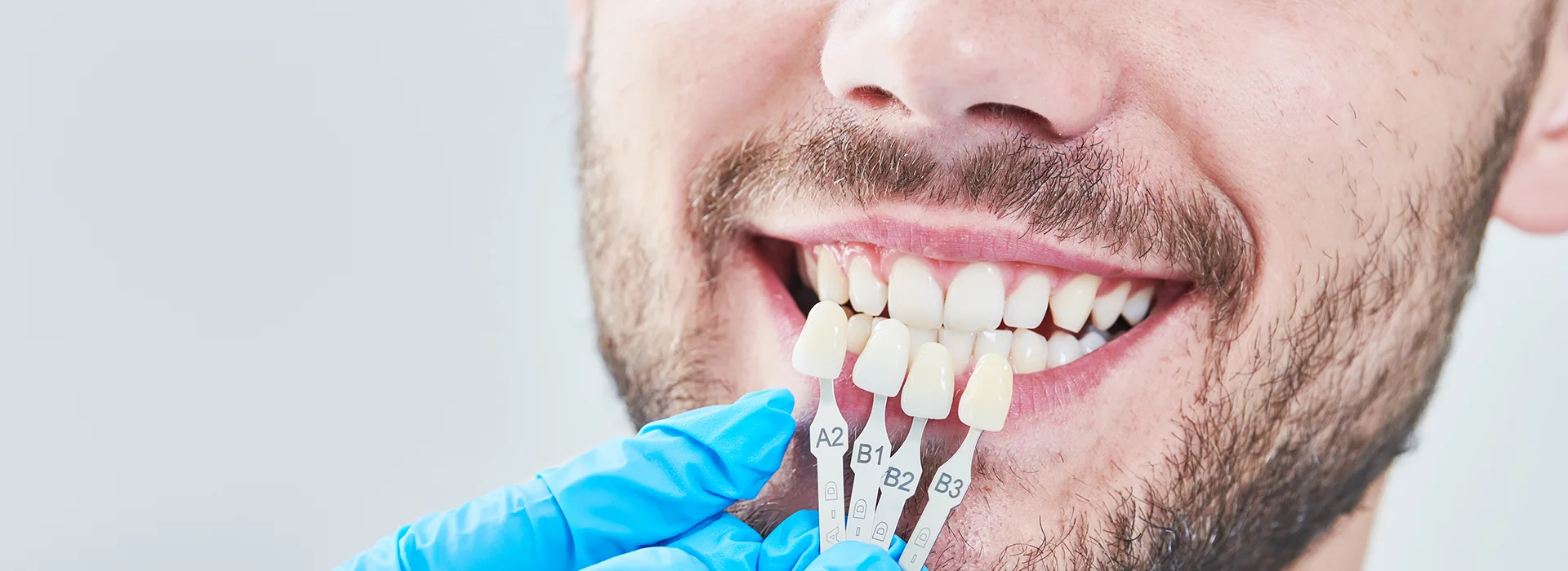 Close up of smiling man holding tooth shade guide to compare whiteness options for a smile makeover in a professional dental setting.